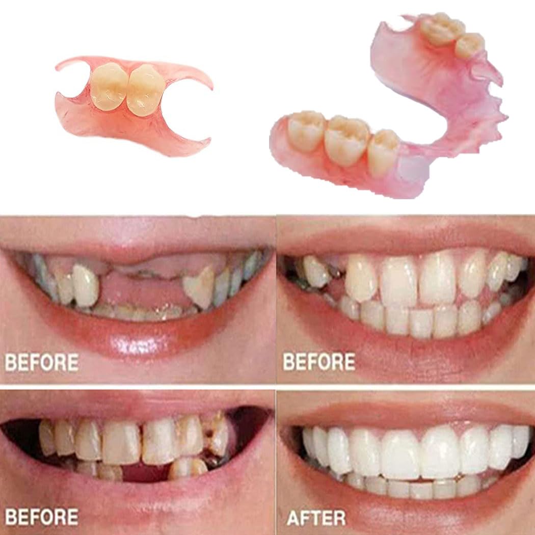 Fake Tooth Repair Kit H8798